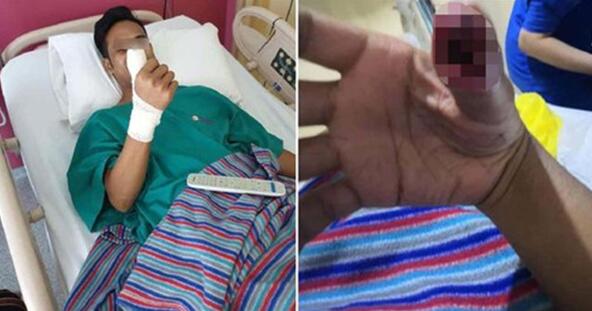 �D���֙C�NĤ�ƕ��p����ָ